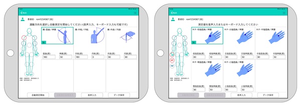 Fujitsu Launches AI-powered Physical Rehabilitation Solution 'HOPE ROMREC' in Japan
