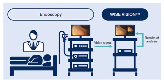 NEC Releases 'WISE VISION Endoscopy' in Europe and Japan