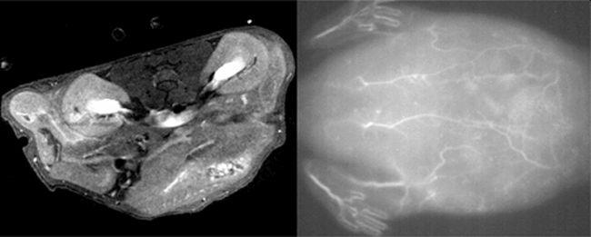 Size matters: Bimodal imaging receives nanoparticle enhancement