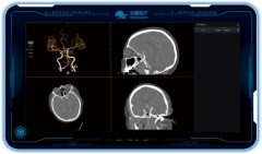重磅 深睿醫療6大創新任務榮登工信部、藥監局揭榜名單