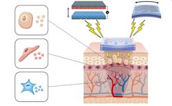 Tiny electric generators could accelerate wound healing