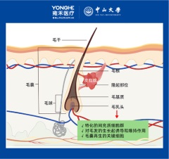 雍禾醫療與中山大學毛囊再生學術成果亮相國際權威學術期刊