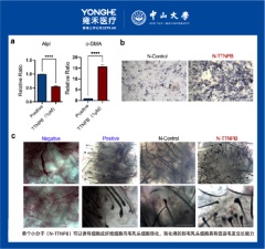 雍禾醫療與中山大學毛囊再生學術成果亮相國際權威學術期刊