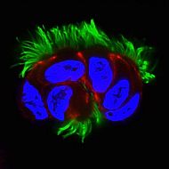 Zebrafish Genes Linked to Human Respiratory Diseases