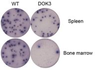Understanding and Improving the Body's Fight Against Pathogens