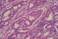 Singapore Scientists Discover New Pathways Leading to Cancer Progression